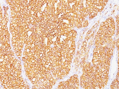 Monoclonal Antibody to Renal Cell Carcinoma / gp200(Clone : SPM487)