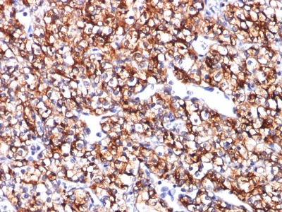 Monoclonal Antibody to Carbonic Anhydrase IX (Renal Cell Marker)(Clone : CA9/781)