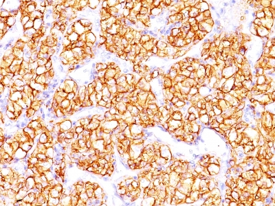 Monoclonal Antibody to Proximal Nephrogenic Antigen (Renal Cell Marker)(Clone : PN-15)