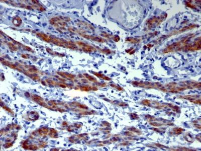 Monoclonal Antibody to Caldesmon, HMW (h-Caldesmon) (Smooth Muscle Marker)(Clone : h-CALD)