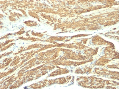 Monoclonal Antibody to Caldesmon, HMW (h-Caldesmon) (Smooth Muscle Marker)(Clone : SPM168)