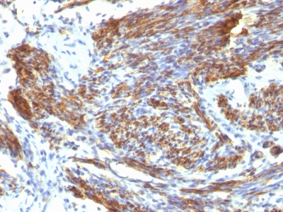 Monoclonal Antibody to Caldesmon, HMW (h-Caldesmon) (Smooth Muscle Marker)(Clone : CALD1/820)