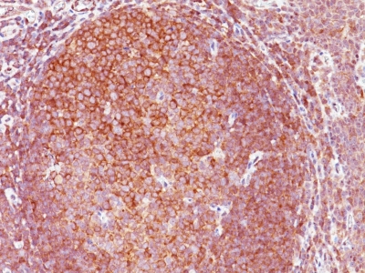 Monoclonal Antibody to BCL10 (MALT-Lymphoma Marker)(Clone : BL10/411)