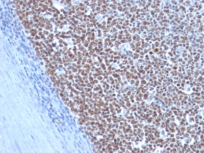 Monoclonal Antibody to Cyclin B1 (G2- & M-phase Cyclin)(Clone : CCNB1/1098)