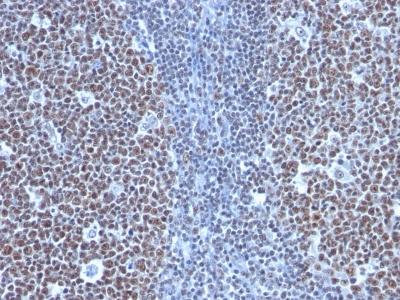 Monoclonal Antibody to Cyclin B1 (G2- & M-phase Cyclin)(Clone : SPM619)