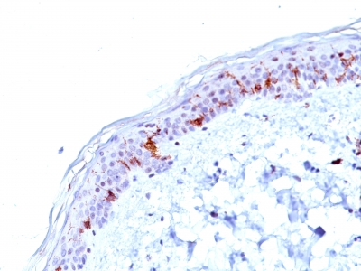 Monoclonal Antibody to CD1a / HTA1 (Mature Langerhans Cells Marker)(Clone : O10)