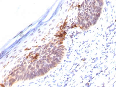 Monoclonal Antibody to CD1a (Mature Langerhans Cells Marker)(Clone : SPM120)