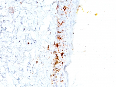 Monoclonal Antibody to CD1a / HTA1 (Mature Langerhans Cells Marker)(Clone : C1A/711)