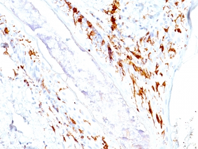 Monoclonal Antibody to CD1a / HTA1 (Mature Langerhans Cells Marker)(O10 + C1A/711)