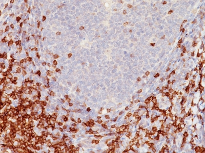 Monoclonal Antibody to CD5 (Mantle Cell Lymphoma Marker)(Clone : C5/473)