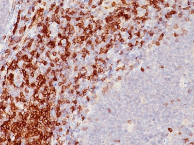 Monoclonal Antibody to CD5 (Mantle Cell Lymphoma Marker)(Clone : SPM546)