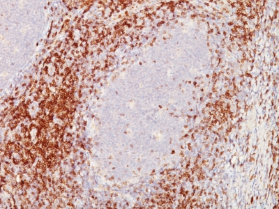 Monoclonal Antibody to CD5 (Mantle Cell Lymphoma Marker)(C5/473 + CD5/54/F6)