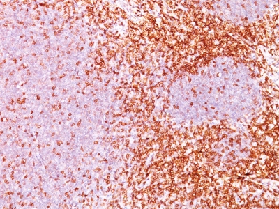 Monoclonal Antibody to CD6(Clone : 3F7B5)