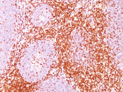 Monoclonal Antibody to CD6(Clone : C6/372)