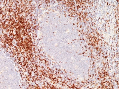 Monoclonal Antibody to CD6(C6/372 + 3F7B5)