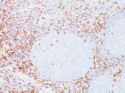 Monoclonal Antibody to CD8A (Cytotoxic- & Suppressor T-Cell Marker)(Clone : C8/468)