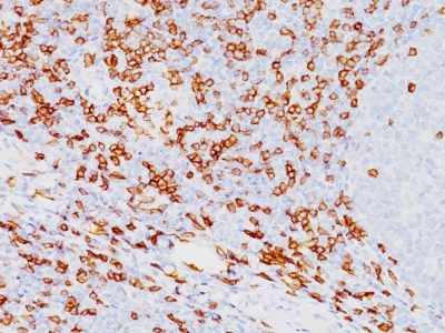 Monoclonal Antibody to CD8A (Cytotoxic- & Suppressor T-Cell Marker)(Clone : SPM548)