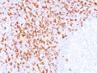 Monoclonal Antibody to CD8A (Cytotoxic / Suppressor T-Cell Marker)(Clone : C8/144B)