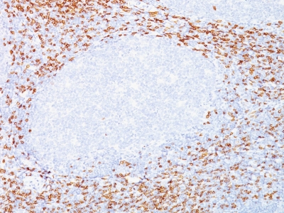 Monoclonal Antibody to CD8A (Cytotoxic- & Suppressor T-Cell Marker)(C8/468 + C8/144B)