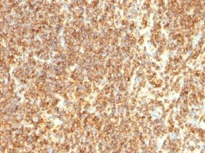 Monoclonal Antibody to CD20 / MS4A1 (B-Cell Marker)(Clone : SPM494)