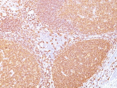 Monoclonal Antibody to CD20 / MS4A1 (B-Cell Marker)(Clone : IGEL/773)