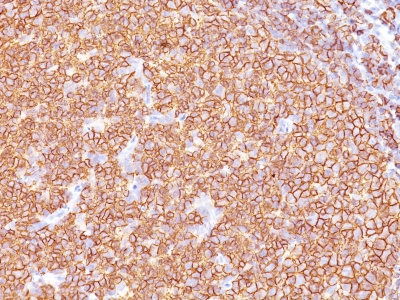 Monoclonal Antibody to CD20 / MS4A1 (B-Cell Marker)(Clone : SPM618)