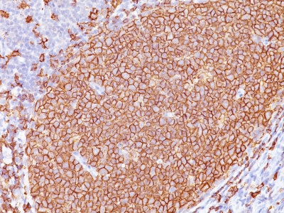 Monoclonal Antibody to CD20 / MS4A1 (B-Cell Marker)(L26 + IGEL/773)