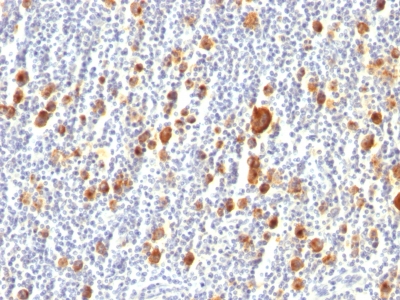 Monoclonal Antibody to CD30 / TNFRSF8 (Hodgkin & Reed-Sternberg Cell Marker)(Clone : Ber-H2)