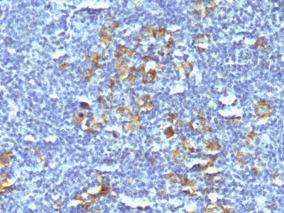 Monoclonal Antibody to CD30 / TNFRSF8 (Hodgkin & Reed-Sternberg Cell Marker)(Clone : SPM121)