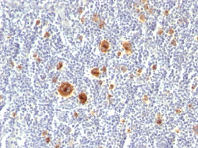 Monoclonal Antibody to CD30 / TNFRSF8 (Hodgkin & Reed-Sternberg Cell Marker)(Clone : Ki-1/779)