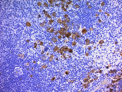 Monoclonal Antibody to CD30 / TNFRSF8 (Hodgkin & Reed-Sternberg Cell Marker)(Ber-H2 + CD30/412)