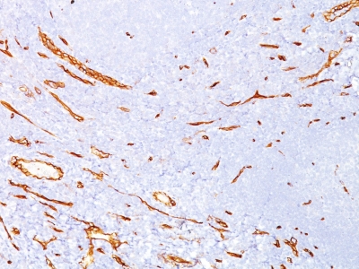 Monoclonal Antibody to CD34 (Hematopoietic Stem Cell & Endothelial Marker)(Clone : QBEnd/10)