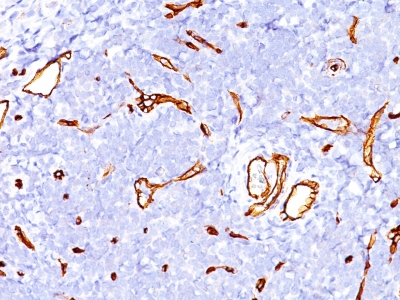 Monoclonal Antibody to CD34 (Hematopoietic Stem Cell & Endothelial Marker)(Clone : SPM123)