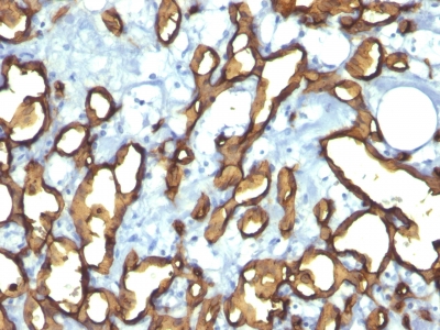 Monoclonal Antibody to CD34 (Hematopoietic Stem Cell & Endothelial Marker)(Clone : HPCA1/763)