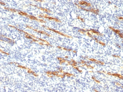 Monoclonal Antibody to CD34 (Hematopoietic Stem Cell & Endothelial Marker)(QBEnd/10 + HPCA1/763)