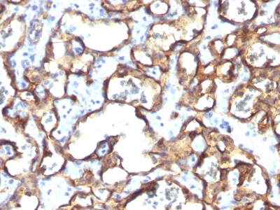 Monoclonal Antibody to CD34 (Hematopoietic Stem Cell & Endothelial Marker)(Clone : HPCA1/1171)