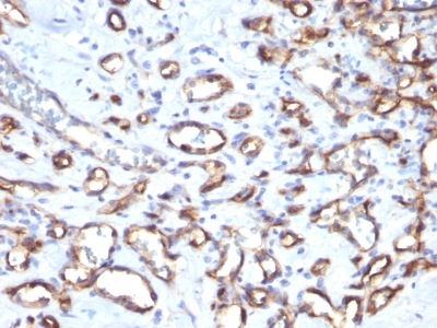 Monoclonal Antibody to CD34 (Hematopoietic Stem Cell & Endothelial Marker)(Clone : SPM610)