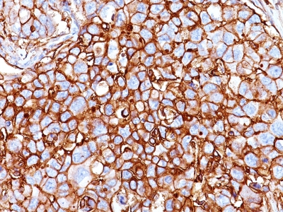 Monoclonal Antibody to CD44 / HCAM Std.(Clone : HCAM/918)