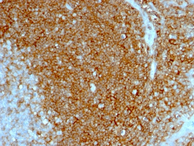 Monoclonal Antibody to CD44 / HCAM Std.(Clone : HCAM/1097)