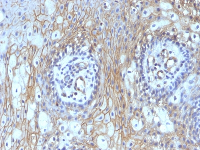 Monoclonal Antibody to CD59 / Complement Regulatory Protein / Protectin(Clone : MACIF/629)