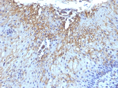 Monoclonal Antibody to CD59 / Complement Regulatory Protein / Protectin(Clone : SPM616)