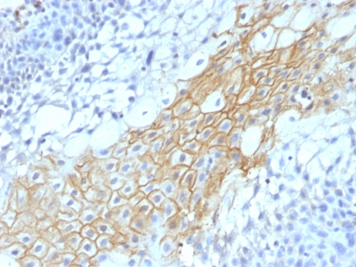 Monoclonal Antibody to CD59 / Complement Regulatory Protein / Protectin(Clone : MACIF/1193)