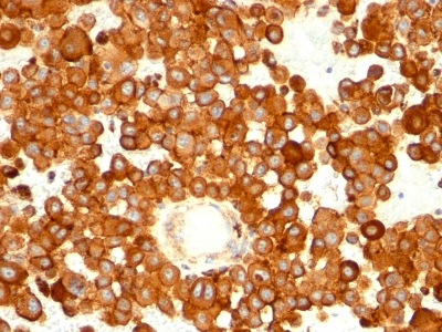 Monoclonal Antibody to CD63 (Late Endosomes Marker)(Clone : MX-49.129.5)