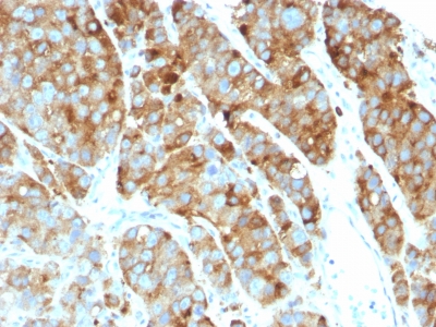 Monoclonal Antibody to CD63 (Late Endosomes Marker)(Clone : LAMP3/968)