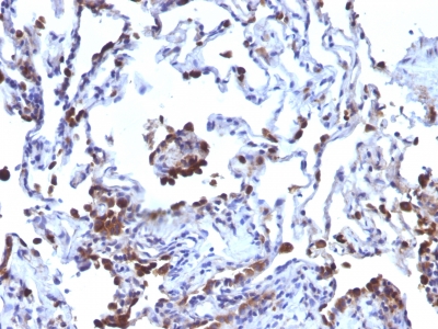 Monoclonal Antibody to CD63 (Late Endosomes Marker)(NKI/C3 + LAMP3/968)