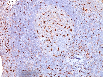 Monoclonal Antibody to CD68 (Macrophage Marker)(Clone : SPM130)