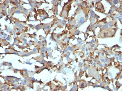 Monoclonal Antibody to CD68 (Macrophage Marker)(KP1 + C68/684)