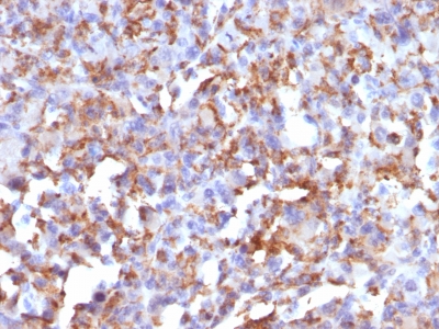 Monoclonal Antibody to CD68 (Macrophage Marker)(Clone : LAMP4/824)