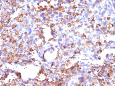 Monoclonal Antibody to CD68 (Macrophage Marker)(Clone : CD68/G2)