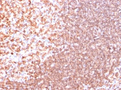 Monoclonal Antibody to CD74 (B-Cell Marker)(Clone : SPM523)